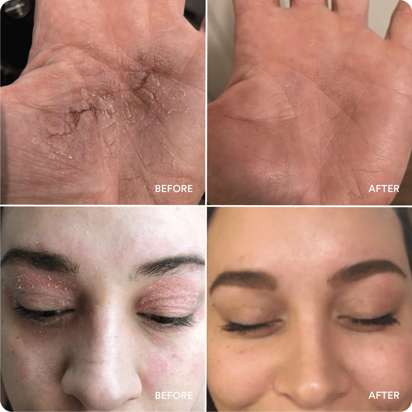 Marin Soothing Hydration Cream